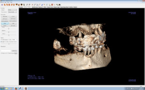 3D rontgen 