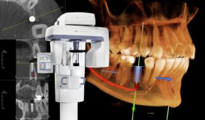 CBCT dental scanner Bratislava